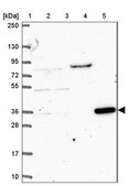 Anti-CLN6 antibody produced in rabbit Prestige Antibodies&#174; Powered by Atlas Antibodies, affinity isolated antibody, buffered aqueous glycerol solution