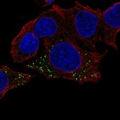 Anti-HBB antibody produced in rabbit Prestige Antibodies&#174; Powered by Atlas Antibodies, affinity isolated antibody, buffered aqueous glycerol solution