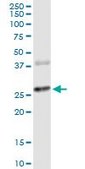 Monoclonal Anti-CTLA4 antibody produced in mouse clone 2F1, purified immunoglobulin, buffered aqueous solution