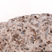 Monoclonal Anti-Adam10 Antibody Produced In Mouse Prestige Antibodies&#174; Powered by Atlas Antibodies, clone CL13809, affinity isolated antibody, buffered aqueous glycerol solution