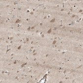 Anti-HMGCR antibody produced in rabbit Prestige Antibodies&#174; Powered by Atlas Antibodies, affinity isolated antibody, buffered aqueous glycerol solution