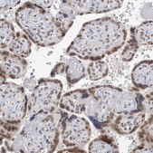 Anti-TREX1 antibody produced in rabbit Prestige Antibodies&#174; Powered by Atlas Antibodies, affinity isolated antibody, buffered aqueous glycerol solution