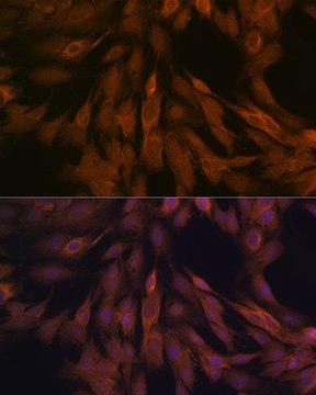 Anti-ULK3 Antibody, clone 5Z7Z6, Rabbit Monoclonal