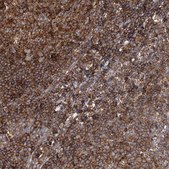 Anti-SEC24B antibody produced in rabbit Prestige Antibodies&#174; Powered by Atlas Antibodies, affinity isolated antibody, buffered aqueous glycerol solution