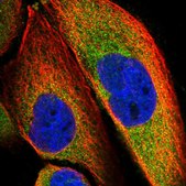 Anti-SLC9A5 antibody produced in rabbit Prestige Antibodies&#174; Powered by Atlas Antibodies, affinity isolated antibody, buffered aqueous glycerol solution