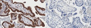 Anti-ACSL3 Antibody, clone 1I18 ZooMAb&#174; Rabbit Monoclonal recombinant, expressed in HEK 293 cells