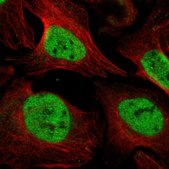 Anti-UNC93B1 antibody produced in rabbit Prestige Antibodies&#174; Powered by Atlas Antibodies, affinity isolated antibody