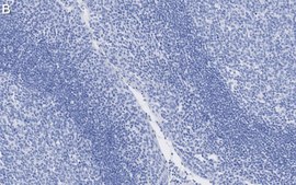 Anti-&#946;-Tubulin Antibody, clone 1C9 ZooMAb&#174; Rabbit Monoclonal recombinant, expressed in HEK 293 cells