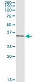 Monoclonal Anti-NR0B2 antibody produced in mouse clone 1A11, purified immunoglobulin, buffered aqueous solution