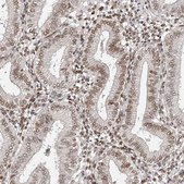 Anti-ZNF503 antibody produced in rabbit Prestige Antibodies&#174; Powered by Atlas Antibodies, affinity isolated antibody, buffered aqueous glycerol solution