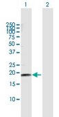 Anti-NETO2 antibody produced in mouse purified immunoglobulin, buffered aqueous solution