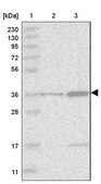 Anti-TRDMT1 antibody produced in rabbit Prestige Antibodies&#174; Powered by Atlas Antibodies, affinity isolated antibody, buffered aqueous glycerol solution