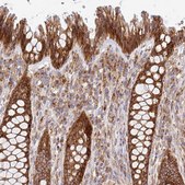Anti-IDUA antibody produced in rabbit Prestige Antibodies&#174; Powered by Atlas Antibodies, affinity isolated antibody, buffered aqueous glycerol solution