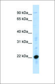 Anti-CRIP2 antibody produced in rabbit affinity isolated antibody