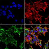 Monoclonal Anti-Lrrk2/Dardarin - Rpe antibody produced in mouse clone S231B-34, purified immunoglobulin