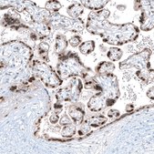 Anti-NR4A3 antibody produced in rabbit Prestige Antibodies&#174; Powered by Atlas Antibodies, affinity isolated antibody, buffered aqueous glycerol solution