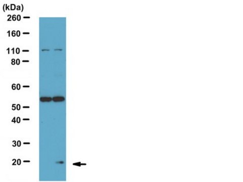 Anti-Phospho- Bad (Ser75) Antibody from rabbit