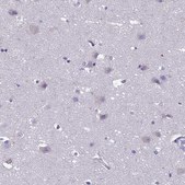 Anti-CRB2 antibody produced in rabbit Prestige Antibodies&#174; Powered by Atlas Antibodies, affinity isolated antibody, buffered aqueous glycerol solution