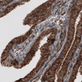 Monoclonal Anti-CARS antibody produced in mouse Prestige Antibodies&#174; Powered by Atlas Antibodies, clone CL2302, purified immunoglobulin, buffered aqueous glycerol solution