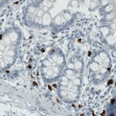 Monoclonal Anti-MMP9 antibody produced in mouse Prestige Antibodies&#174; Powered by Atlas Antibodies, clone CL0538, purified immunoglobulin, buffered aqueous glycerol solution