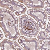 Anti-CXCR5 antibody produced in rabbit Prestige Antibodies&#174; Powered by Atlas Antibodies, affinity isolated antibody, buffered aqueous glycerol solution