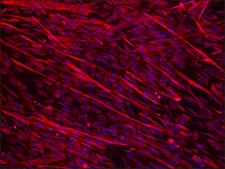 Anti-Dysferlin (N-terminal region) antibody produced in rabbit ~1.5&#160;mg/mL, affinity isolated antibody