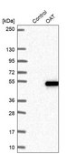 Anti-OAT antibody produced in rabbit Prestige Antibodies&#174; Powered by Atlas Antibodies, affinity isolated antibody, buffered aqueous glycerol solution