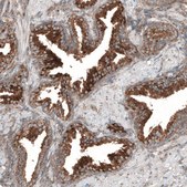 Anti-LZTR1 antibody produced in rabbit Prestige Antibodies&#174; Powered by Atlas Antibodies, affinity isolated antibody, buffered aqueous glycerol solution