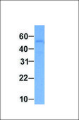 Anti-ABAT antibody produced in rabbit affinity isolated antibody