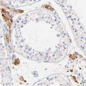 Anti-EBP antibody produced in rabbit Prestige Antibodies&#174; Powered by Atlas Antibodies, affinity isolated antibody, buffered aqueous glycerol solution