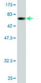 Monoclonal Anti-ALDH1A1 antibody produced in mouse clone 1G6, purified immunoglobulin, buffered aqueous solution