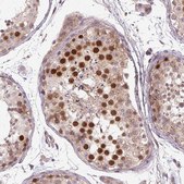 Anti-KIFC1 antibody produced in rabbit Prestige Antibodies&#174; Powered by Atlas Antibodies, affinity isolated antibody, buffered aqueous glycerol solution