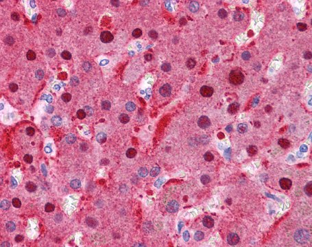 Anti-FAH antibody produced in rabbit affinity isolated antibody