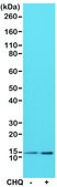 Anti-LC3B antibody, Rabbit Monoclonal recombinant, expressed in HEK 293 cells, clone RM293, purified immunoglobulin