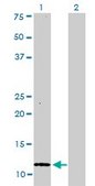 Monoclonal Anti-S100A1 antibody produced in mouse clone 1D5, purified immunoglobulin, buffered aqueous solution