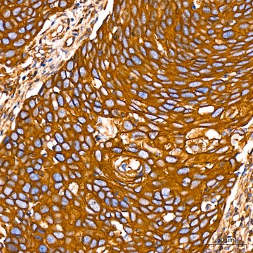 Anti-Filamin A Antibody, clone 3X8Y9, Rabbit Monoclonal