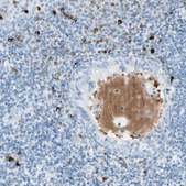 Anti-IL6ST antibody produced in rabbit Prestige Antibodies&#174; Powered by Atlas Antibodies, affinity isolated antibody, buffered aqueous glycerol solution
