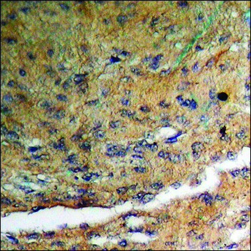 Anti-phospho-GABA-RB (pSer434) antibody produced in rabbit affinity isolated antibody