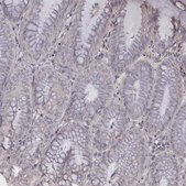 Anti-TNNI1 antibody produced in rabbit Prestige Antibodies&#174; Powered by Atlas Antibodies, affinity isolated antibody, buffered aqueous glycerol solution
