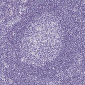 Anti-KRT10 antibody produced in rabbit Prestige Antibodies&#174; Powered by Atlas Antibodies, affinity isolated antibody, buffered aqueous glycerol solution