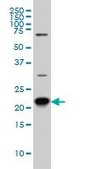 Monoclonal Anti-RAB8A antibody produced in mouse clone 3G1, purified immunoglobulin, buffered aqueous solution