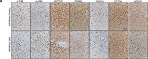Anti-Cyp7a1 Antibody, clone 15B9.1 clone 15B9.1, from mouse