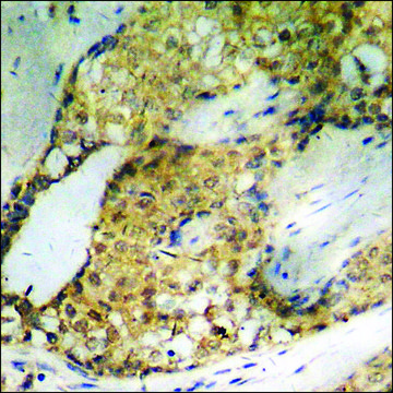 Anti-phospho-ATF2 (pSer62 or 44) antibody produced in rabbit affinity isolated antibody