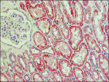 Anti-Lysyl Oxidase (C-terminal) antibody produced in rabbit ~1&#160;mg/mL, affinity isolated antibody, buffered aqueous solution