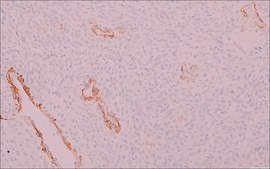 h-Caldesmon (hHCD) Mouse Monoclonal Antibody