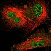 Anti-CDC34 antibody produced in rabbit Prestige Antibodies&#174; Powered by Atlas Antibodies, affinity isolated antibody, buffered aqueous glycerol solution