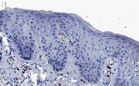 Anti-Cytokeratin-17 Antibody, clone 2K20 ZooMAb&#174; Rabbit Monoclonal recombinant, expressed in HEK 293 cells
