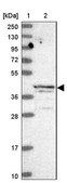 Anti-ALKBH1 antibody produced in rabbit Prestige Antibodies&#174; Powered by Atlas Antibodies, affinity isolated antibody, buffered aqueous glycerol solution
