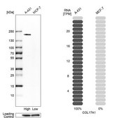 Anti-COL17A1 antibody produced in rabbit Prestige Antibodies&#174; Powered by Atlas Antibodies, affinity isolated antibody, buffered aqueous glycerol solution