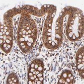 Anti-TXNL1 antibody produced in rabbit Prestige Antibodies&#174; Powered by Atlas Antibodies, affinity isolated antibody, buffered aqueous glycerol solution